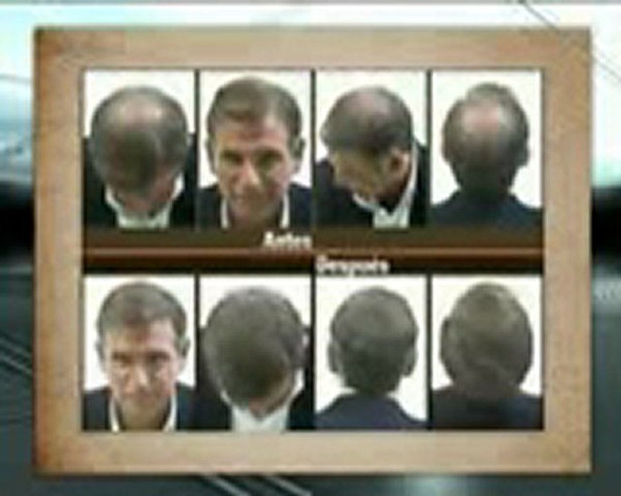 Locuciones para Hair Recovery