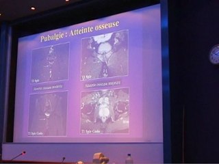 Hanche et pubalgie, 1ère partie (3/4) Diagnostic