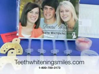 What Are The Side Effects Of Teeth Whitening?