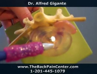 Chiropractor Dr. Gigante explains disc herniation| waldwick