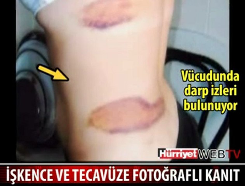İşkenceli Tecavüzün Kanıt Fotoğrafı