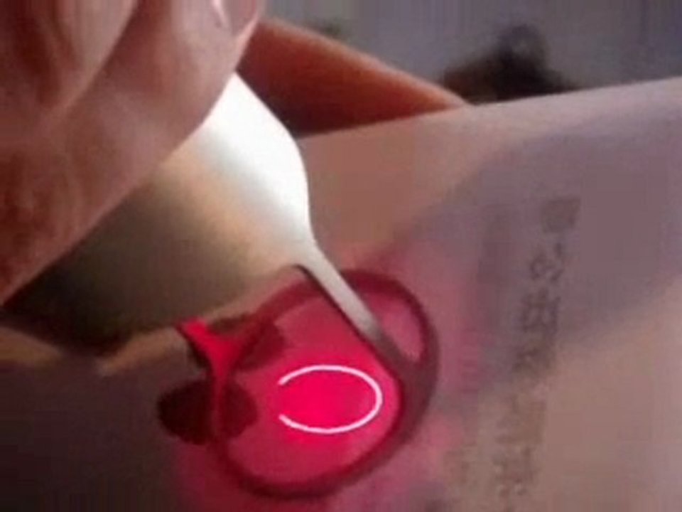 co2 fractional laser  skin resurfacing/ skin rejuvenation op