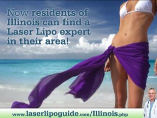 Laser Lipo Illinois