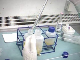 Una terapia celular hace frente a la enfermedad de crohn