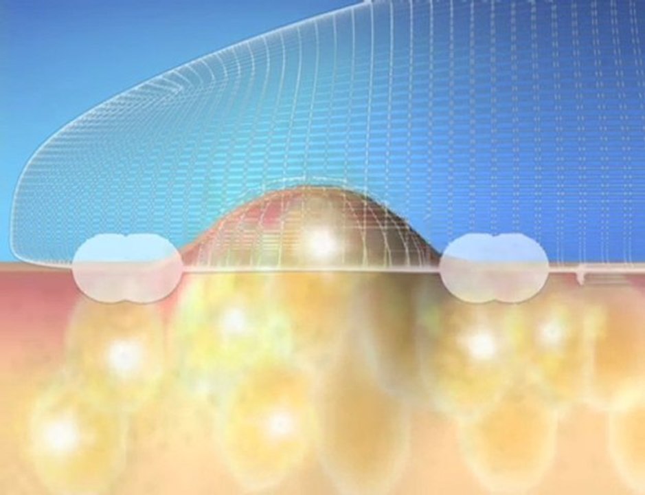 palper rouler spirit beauty - fitness - electrostimulation