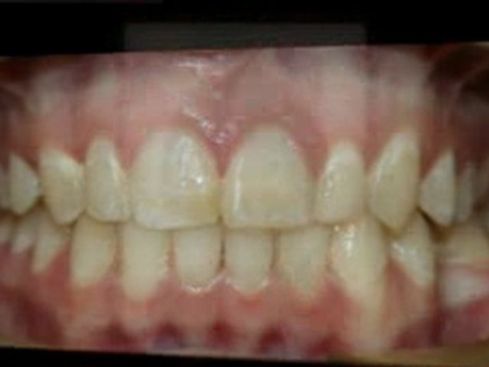 Greeley Orthodontist - Super Smiles By Doctor K