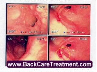 Car accident treatment secrets