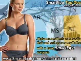 SmartLipo Top Docs Alabama