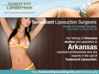 Tumescent Liposuction Arkansas