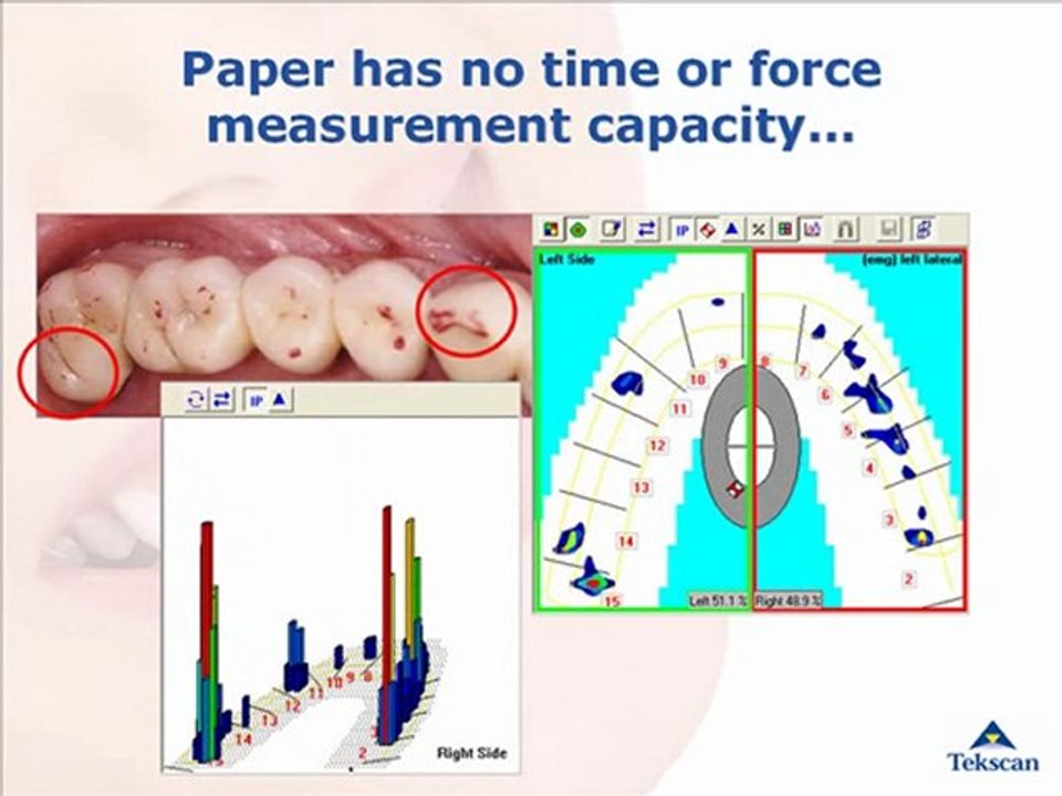 T-Scan Overview