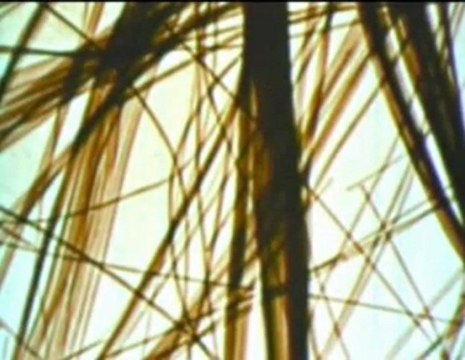 Mesothelioma treatment Facts About Asbestos Lung Mesotheliom