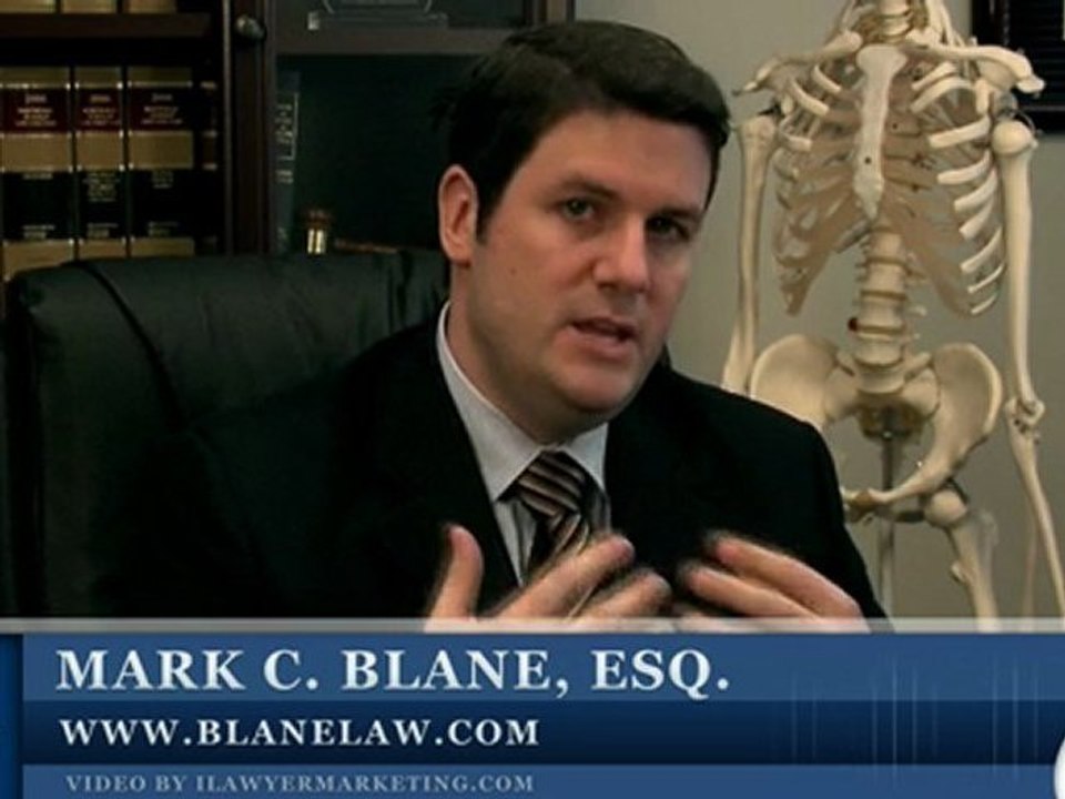 San Diego Personal Injury Lawyer, Injury Attorney Overview
