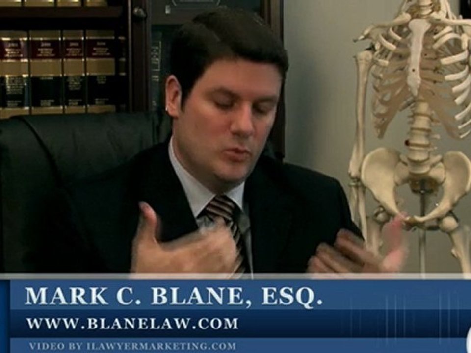 San Diego Personal Injury Attorney - Injury Case Value