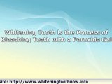 Whitening Tooth: The Secrets Your Dentist Doesn't Want You T