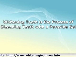 Whitening Tooth: The Secrets Your Dentist Doesn't Want You T