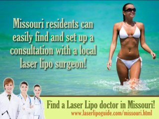 Laser Lipo Missouiri