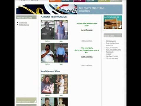 Weight loss surgery Gastric Bypass Surgery - What's Involved