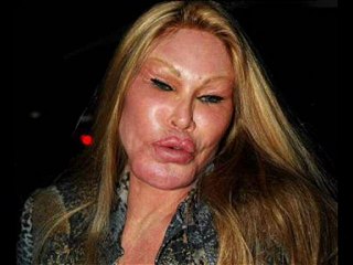 wildenstein's efforts to exist par/by Minamata After Dark