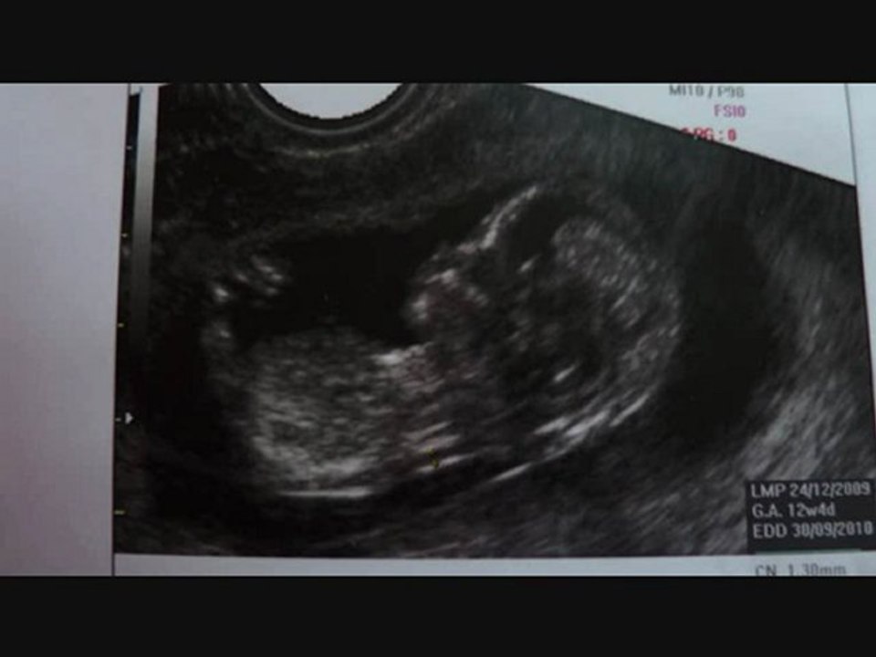 L'histoire s'agrandit !