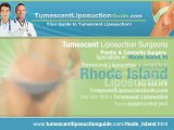 Tumescent Liposuction Rhode Island