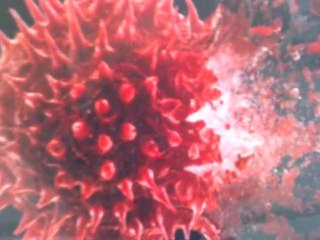 Le sida, tu le perds de vue ,il te tue.