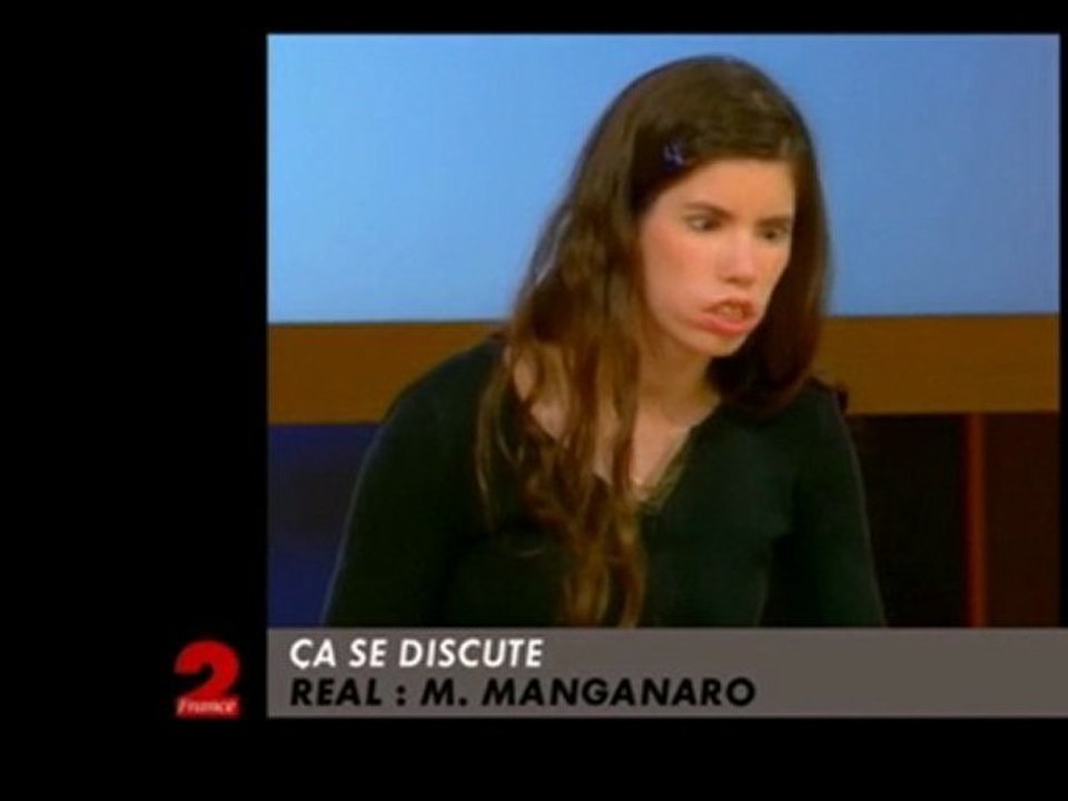 Ca se Discute - Paralysée du visage - Zapping C+