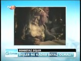 Teoman Doğan & Cem Erdoğan Estetik Diş Estetiği Programı 3