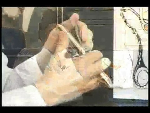 Vasectomy Video - Understanding Anesthesia Methods