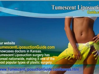 Tumescent Liposuction Kansas