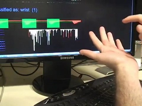 Skinput- Appropriating the Body as an Input Surface