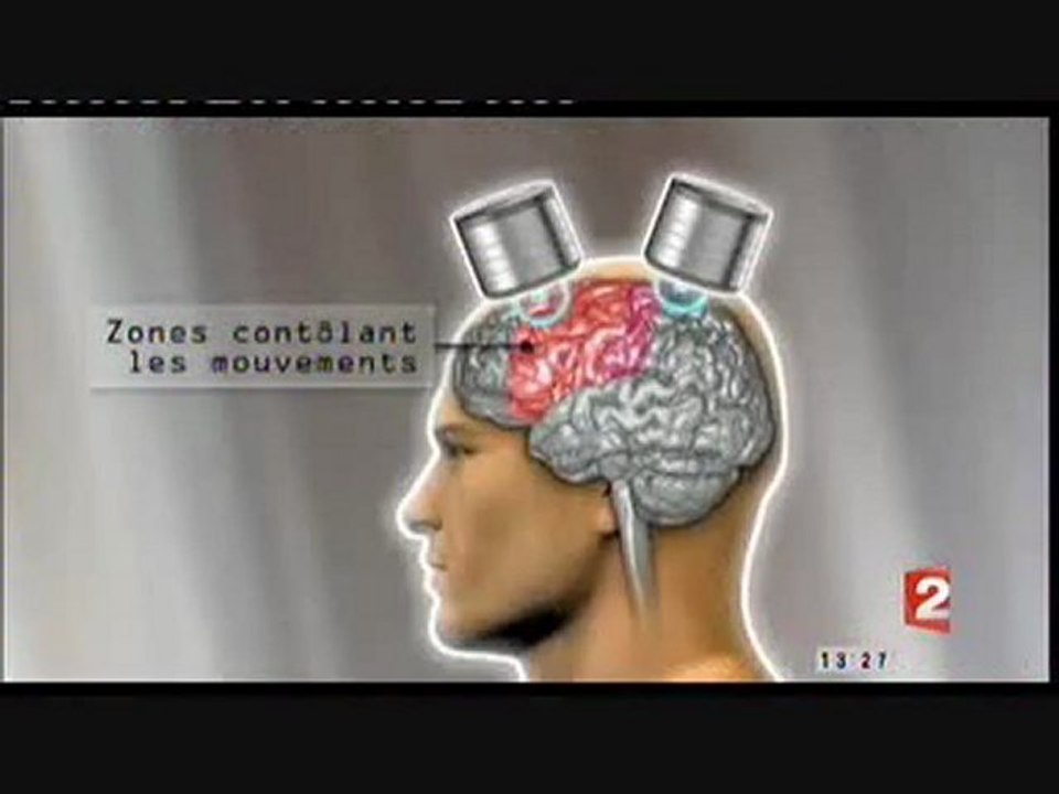 Stimulation electrique transcranienne