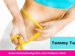 Tummy Tuck Indiana