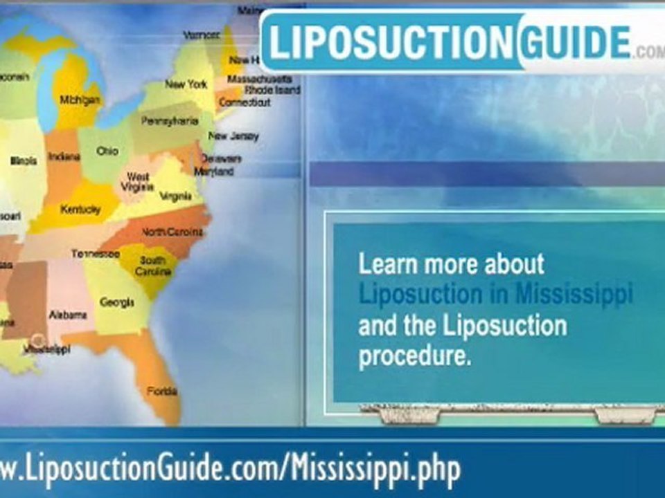 Liposuction Mississippi
