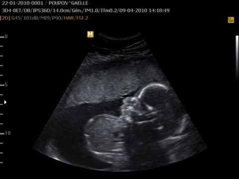 CHARLIE 22 Semaines 9 Avril 2010