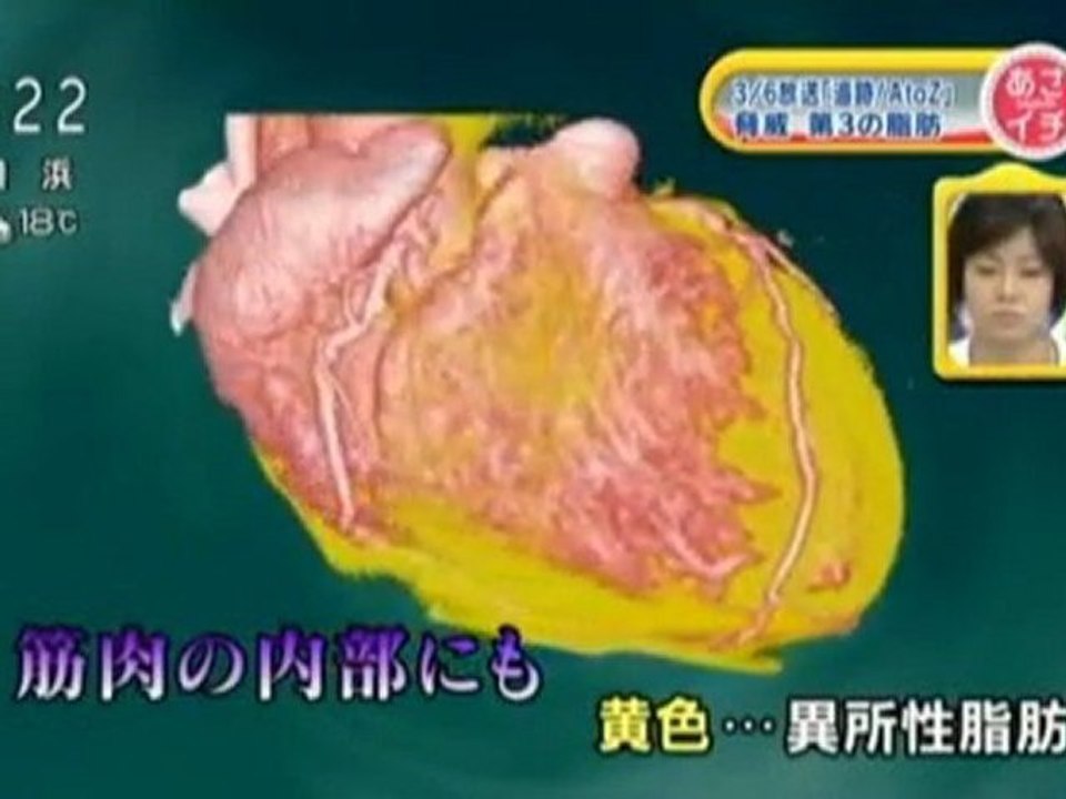 The 3th Fat