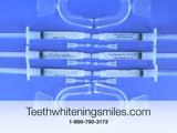 Is Teeth Whitening Permanent?