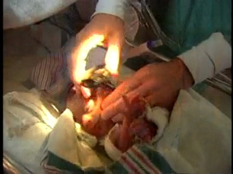 Strategy Confirmed to Help Doctors Determine When to ...
