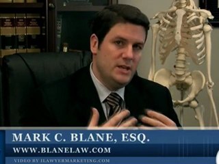 California Personal Injury Lawyer: Ca Auto Accident Practice
