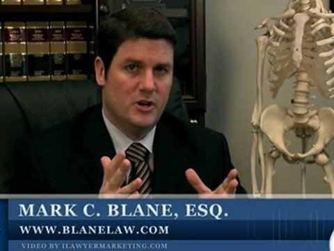 San Diego Premise Liability Injuries: Slip & Fall, Trip & Fa