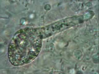 Stentor ceruleum ??? A identifier