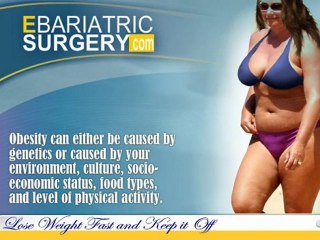Types of Bariatric Surgery: Open & Laparoscopic 🏥