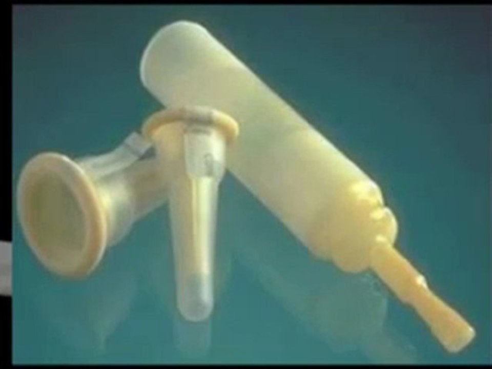 Urinary Catheters 101: Types of Catheters