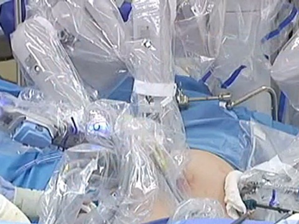 Fully Robotic Gastric Bypass