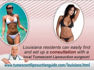Tumescent Liposuction Louisiana
