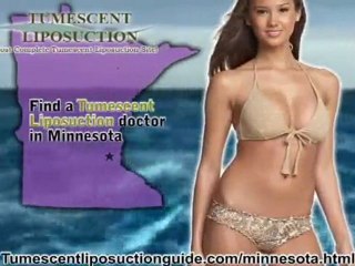 Tumescent Liposuction Minnesota