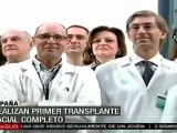 Realizan primer transplante facial completo en España