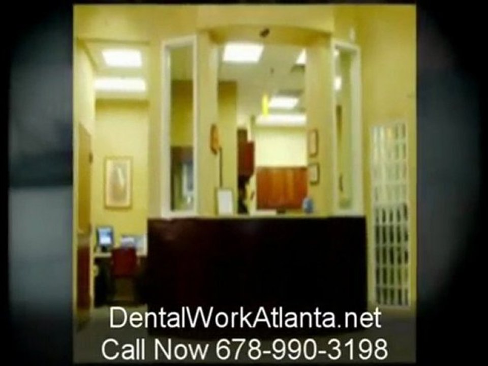 Atlanta Dental Porcelain Veneers