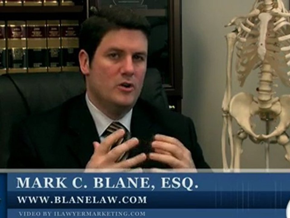 El Cajon Brain Injury Lawyer:  Spinal Cord Injury Liability