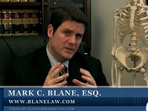 Oceanside Slip and Fall Attorney: Premise Liability Law