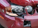 La Jolla Automobile Accident Attorney Explains Auto Injuries